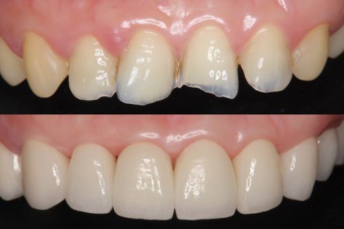 クラウンのメリット・デメリット