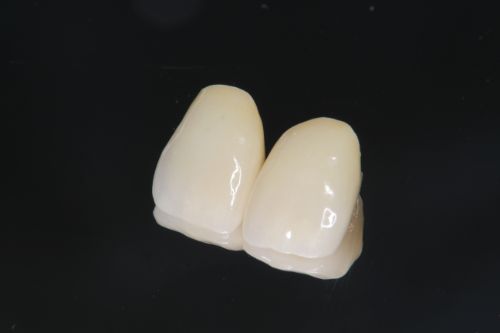 欠損が大きい場合